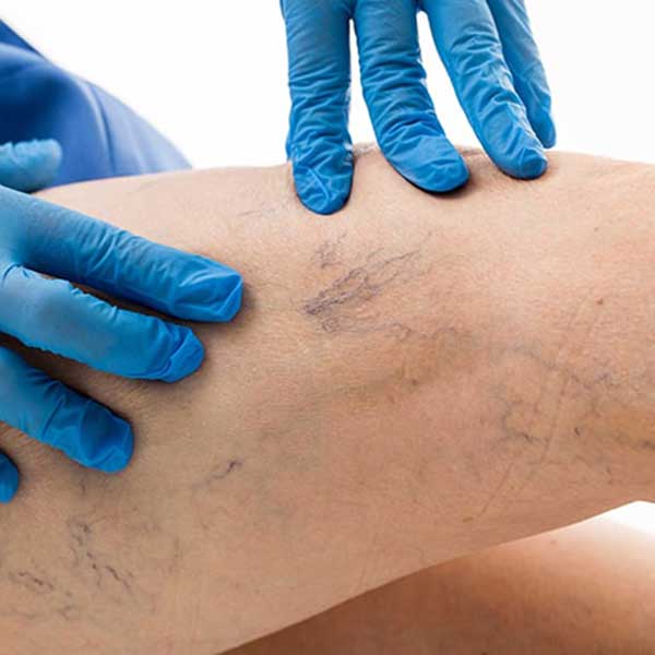 fleboestetica asistprim