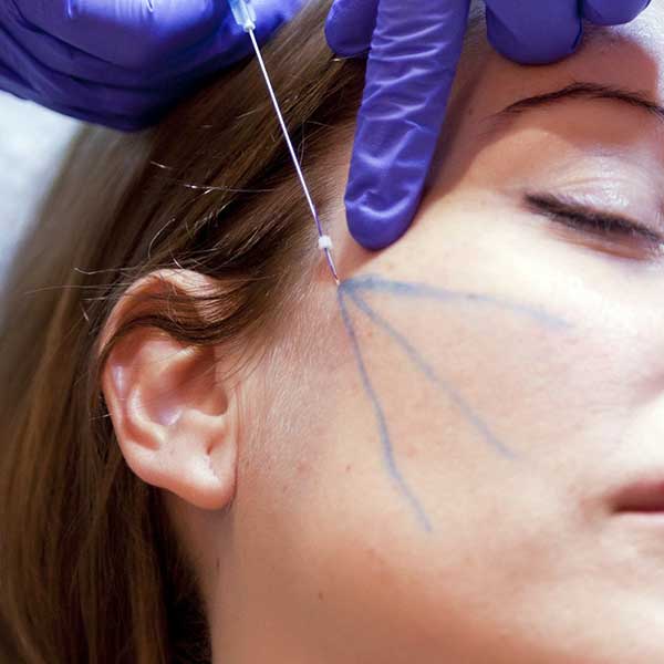 hilos tensores asistprim